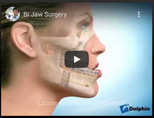 Orthodontic devices - Palatal expander and headgear ©