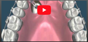 TRACIONAMENTO DE CANINO