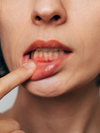 Soins des gencives au cabinet du Dr Thierry Neimann, Paris 8