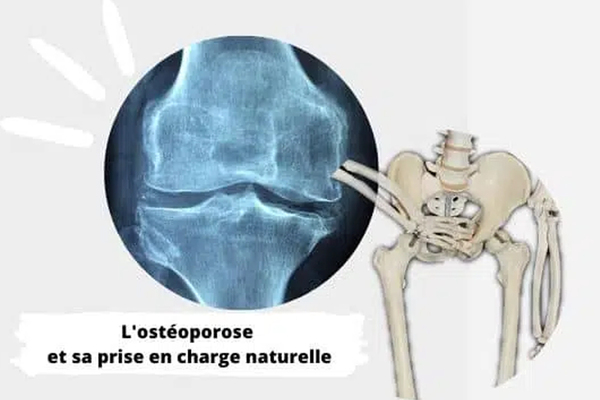 Ostéoporose prise en charge – L’approche naturelle