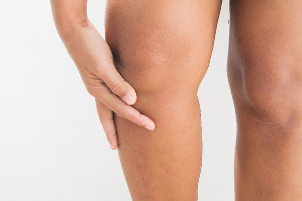 Jambes lourdes, œdèmes, circulation de retour compliquée ? Mes pistes naturelles