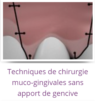 TECHNIQUES DE CHIRURGIE MUCO-GINGIVALES SANS APPORT DE GENCIVE
