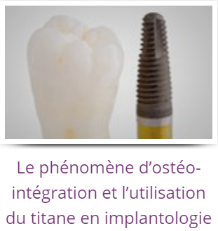 LE PHENOMENE D'OSTEO-INTEGRATION ET L'UTILISATION DU TITANE EN IMPLANTOLOGIE
