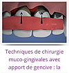 technique de chirurgie muco-gingivales