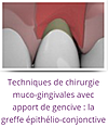technique de chirurgie muco-gingivales et greffe epithélio conjonctive