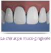 chirurgie muco-gingivale