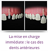 mise en charge immediate