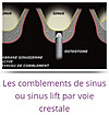 comblement sinus