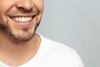 Technique de chirurgie muco-gingivales sans apport de gencives
