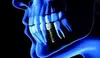 Qu'est-ce qu'un implant ? Indications et contre-indications