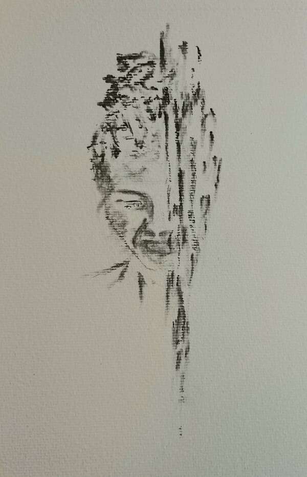 Anorexie restrictive