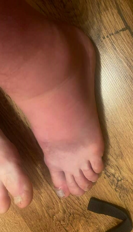 Massage à visée antalgique