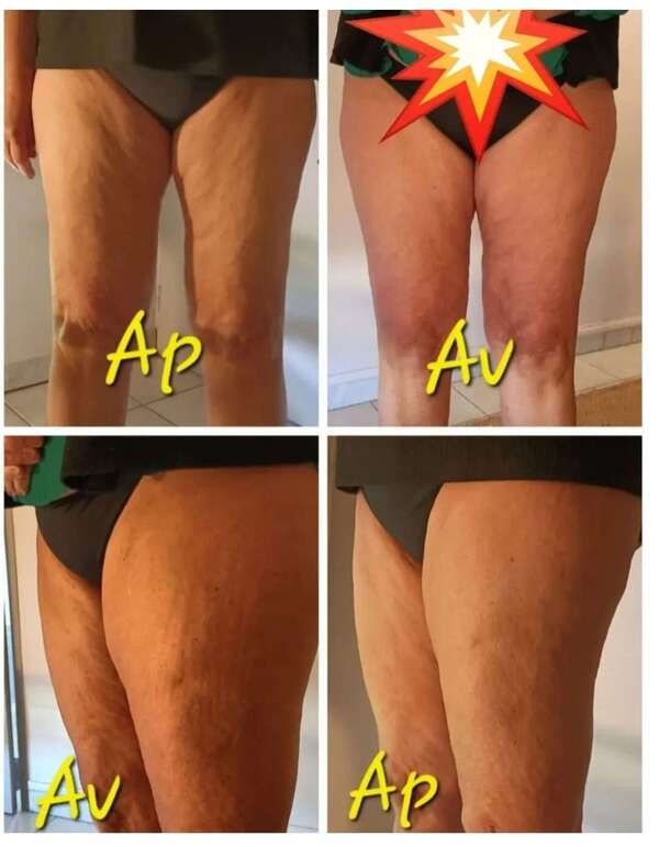 Drainage en hiver? Pourquoi?