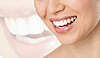 Sourire femme
