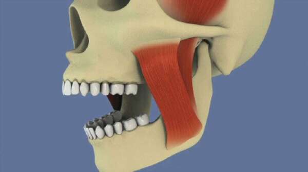 Atm : luxation réductible