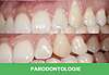 Parodontologie