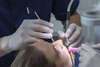 Traitement des dents