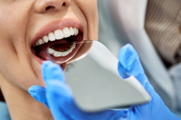 La rééducation linguale