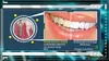 Diagnostic bucco-dentaire