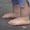 Podologie de l'enfant