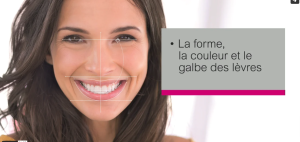 Vidéo explicative du traitement d'orthodontique