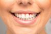 Orthodontie adulte