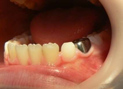 La Couronne pédiatrique