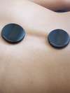 Illustration d'un dos où sont déposées deux pierres chaudes dans le cadre d'un massage pierres chaudes