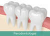 Parodontologie