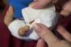 Blessure aux doigts