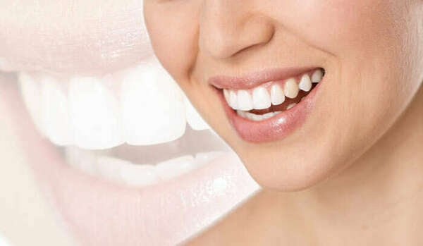 LES IMPLANTS DENTAIRES - LISIEUX - CALVADOS