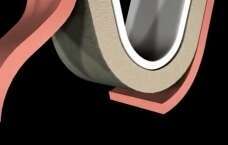 REMPLACER UNE DENT APRES EXTRACTION