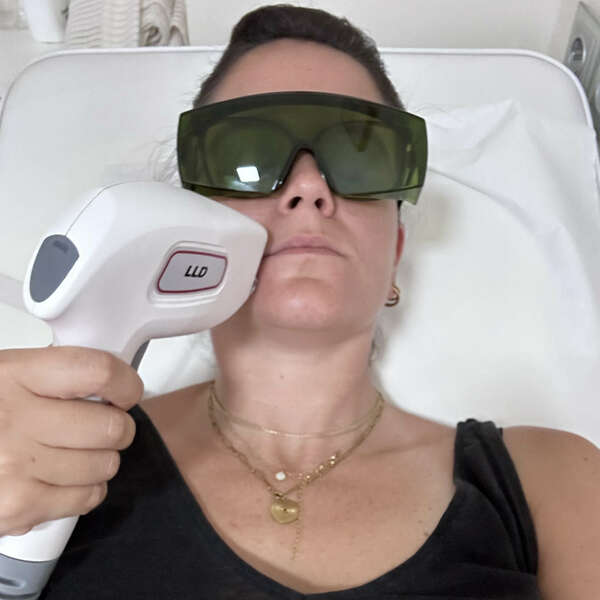 Quel est le meilleur moyen pour traiter la couperose ?