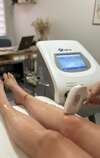 Epilation laser paris