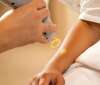 Lasers médicaux pour traitement de la peau
