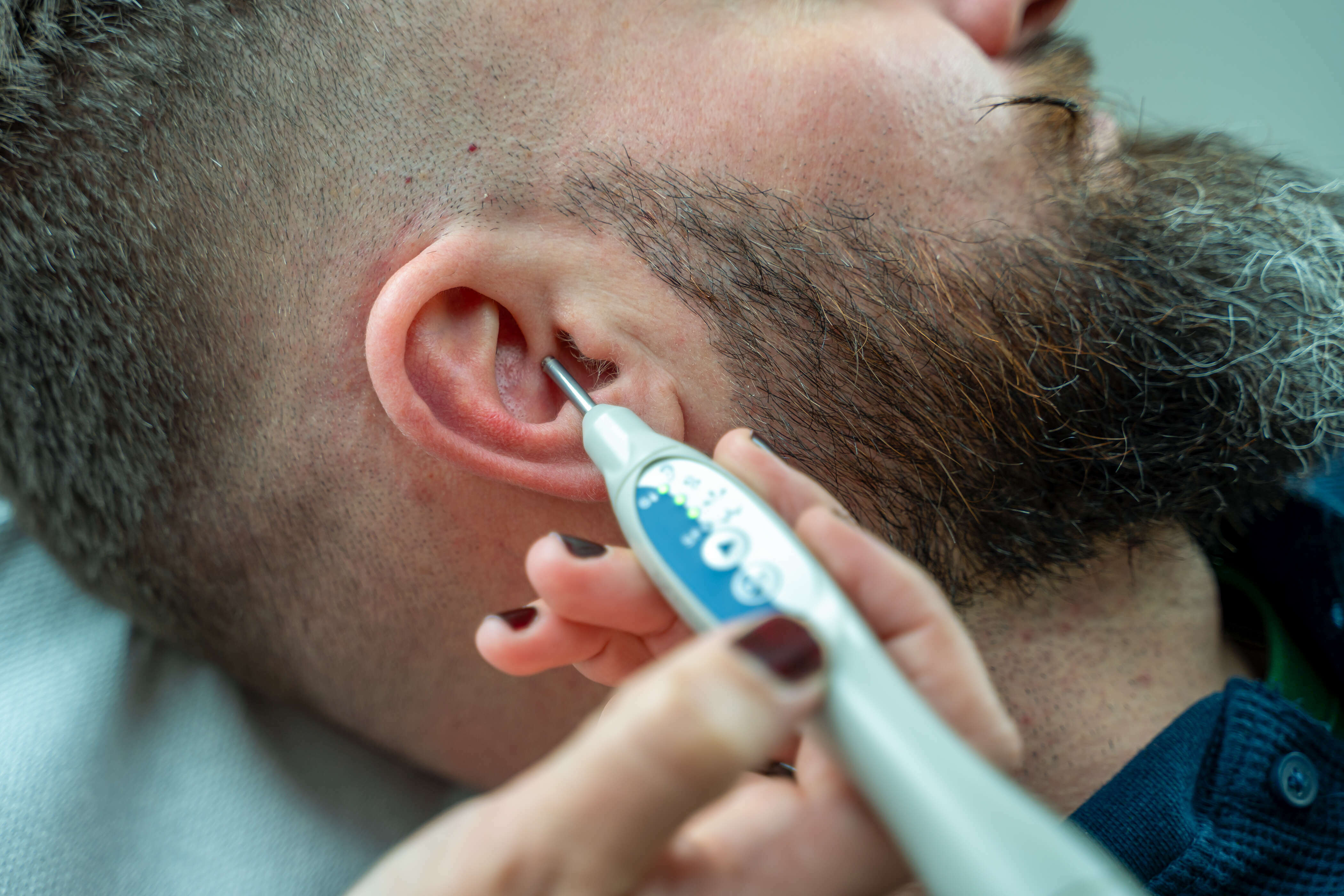cigarette électronique dans les lieux publics Tout savoir sur l'auriculothérapie laser anti tabac main image 1