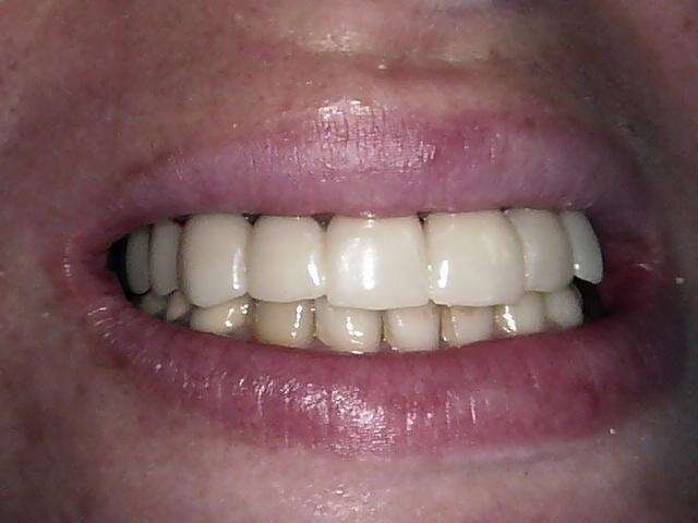 ij5o4mxdlf_1601648541