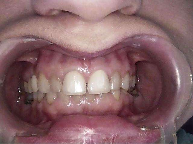 wqpvdmv7cc_1601652771