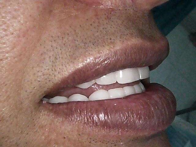 bw5iesap2e_1601648665