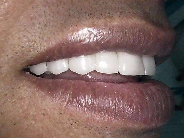 jkofrbupqs_1601648665