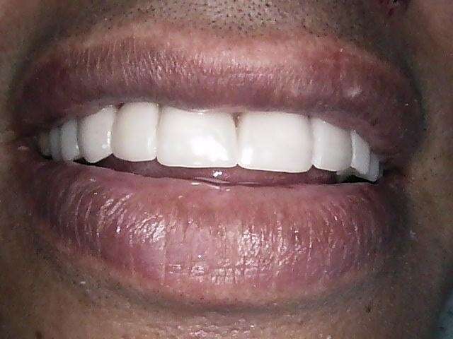 88qphl98de_1601648665