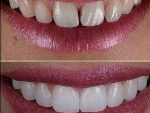 l1tgh9rgio_1601652771