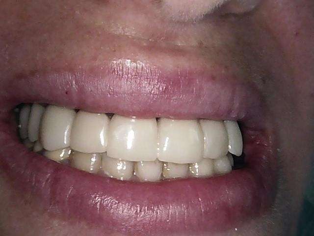 smivxa1u4s_1601648541