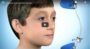 Masque de protraction faciale