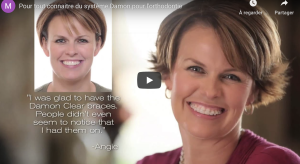 Pour tout connaitre du système Damon pour l'orthodontie