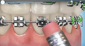 Solutions aux problèmes les plus fréquents