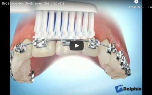 Brossage des dents avec des brackets