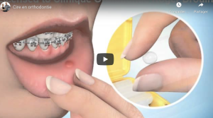 Cire de protection en cas de blessure