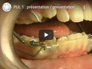 Activateur de type PUL