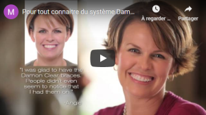 Pour tout connaitre du système Damon